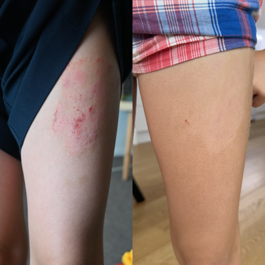 Whipped Barrier Balm - Restore