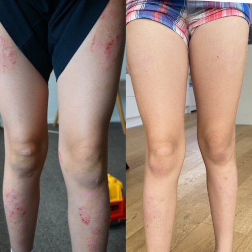 Whipped Barrier Balm - Pure